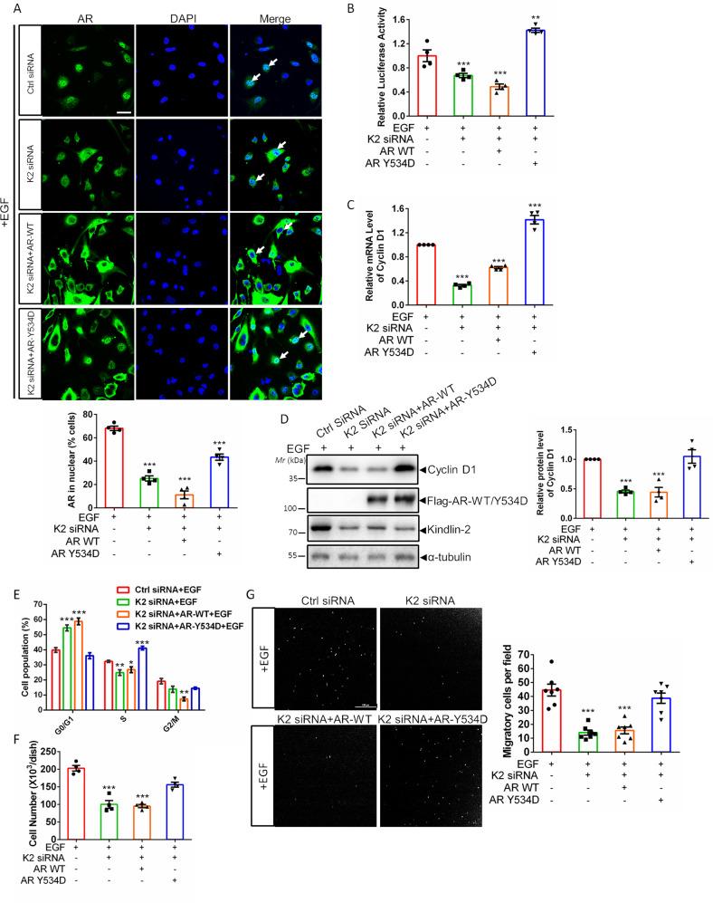 https://cdn.ncbi.nlm.nih.gov/pmc/blobs/dc0b/9122951/c8fba1877ecf/41419_2022_4945_Fig4_HTML.jpg