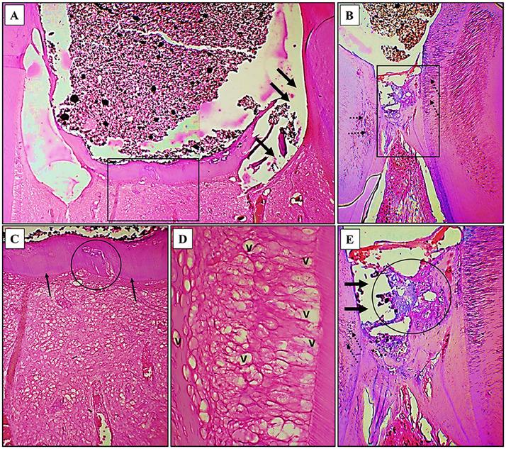 https://cdn.ncbi.nlm.nih.gov/pmc/blobs/dc0d/12145672/4a133b12573d/gr7.jpg