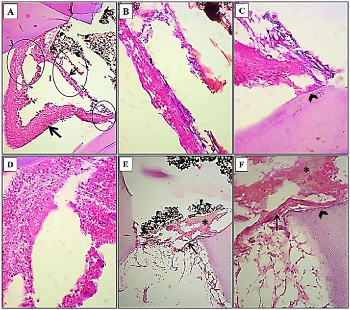 https://cdn.ncbi.nlm.nih.gov/pmc/blobs/dc0d/12145672/61acd3fc8e4c/gr5.jpg