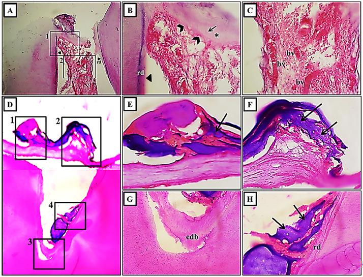 https://cdn.ncbi.nlm.nih.gov/pmc/blobs/dc0d/12145672/de0c530169f0/gr2.jpg