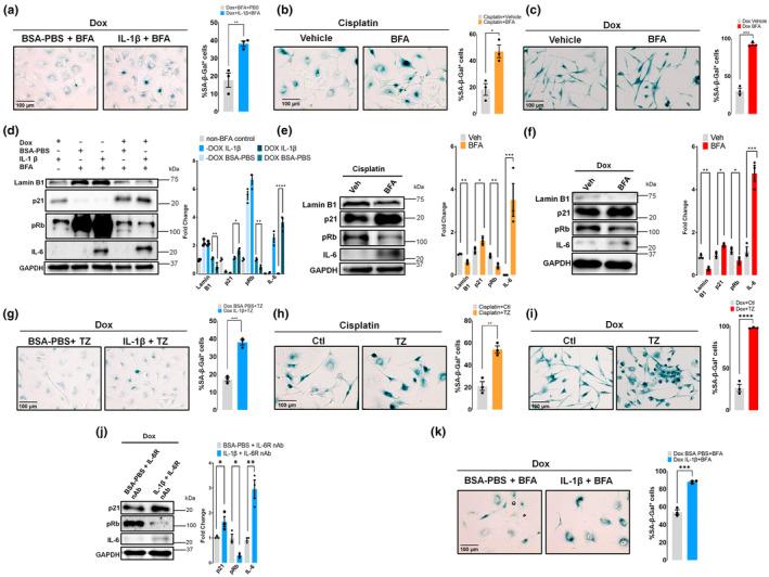 https://cdn.ncbi.nlm.nih.gov/pmc/blobs/dc1b/11464112/79e5fe4b9f93/ACEL-23-e14258-g002.jpg