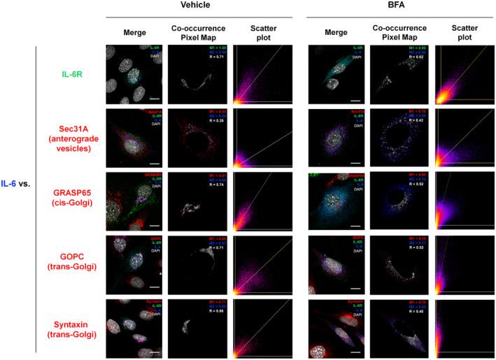 https://cdn.ncbi.nlm.nih.gov/pmc/blobs/dc1b/11464112/daa1515bbfbf/ACEL-23-e14258-g007.jpg