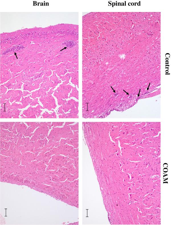 https://cdn.ncbi.nlm.nih.gov/pmc/blobs/dc21/3526473/958b23b10fe2/1742-2094-9-243-4.jpg