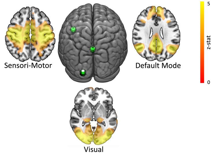 https://cdn.ncbi.nlm.nih.gov/pmc/blobs/dc22/9098424/ede5ced85904/41598_2022_11859_Fig2_HTML.jpg