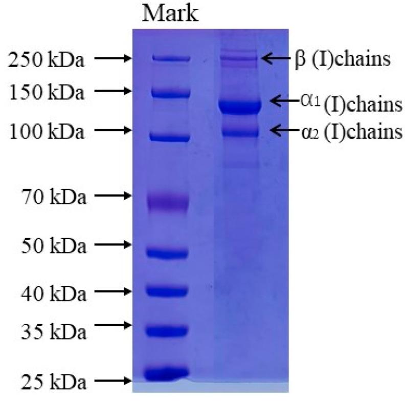 https://cdn.ncbi.nlm.nih.gov/pmc/blobs/dc23/10222667/d3c568d6ca12/marinedrugs-21-00274-g001.jpg