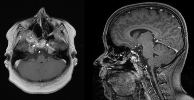https://cdn.ncbi.nlm.nih.gov/pmc/blobs/dc25/9443026/7c4ef9028b71/gr4.jpg