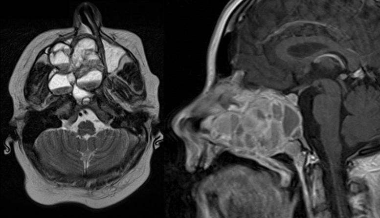 https://cdn.ncbi.nlm.nih.gov/pmc/blobs/dc25/9443026/af5cf826e168/gr2.jpg