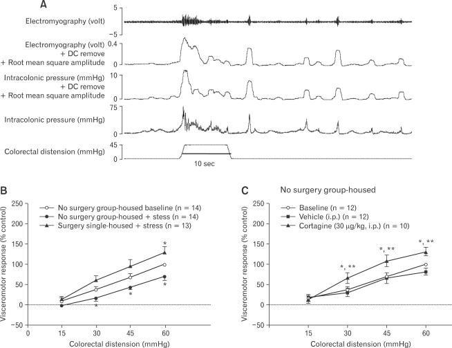 https://cdn.ncbi.nlm.nih.gov/pmc/blobs/dc2d/3155058/47febb63ec1d/jnm-17-213-g001.jpg