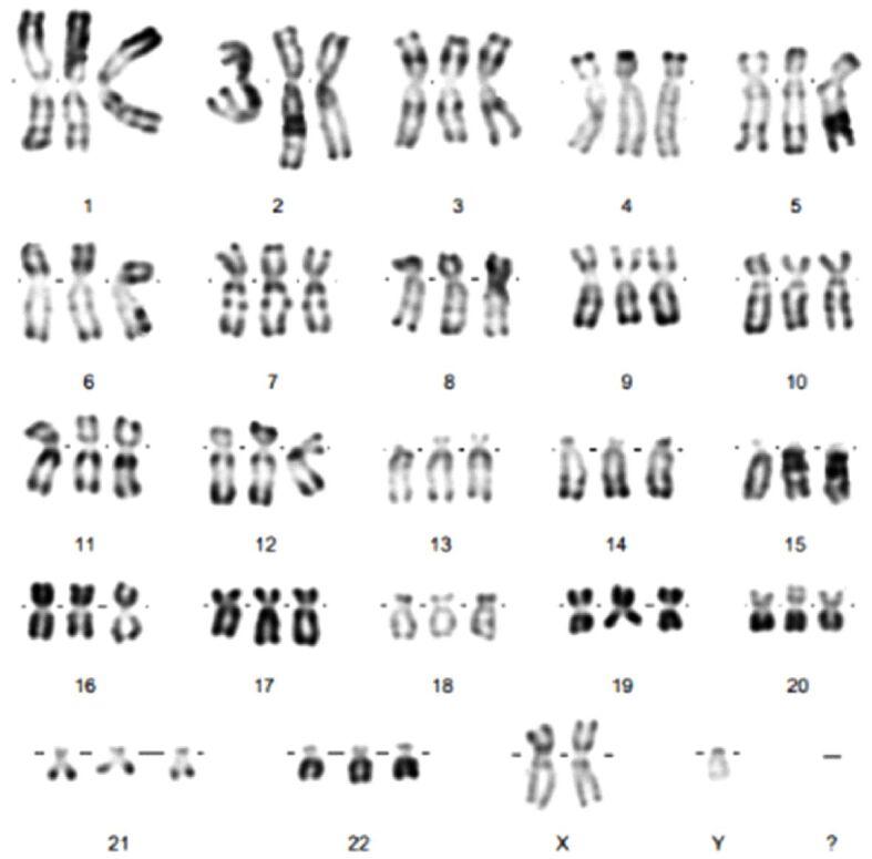 https://cdn.ncbi.nlm.nih.gov/pmc/blobs/dc36/8343603/35c7a3717d8f/RJME-61-4-1309-fig11.jpg