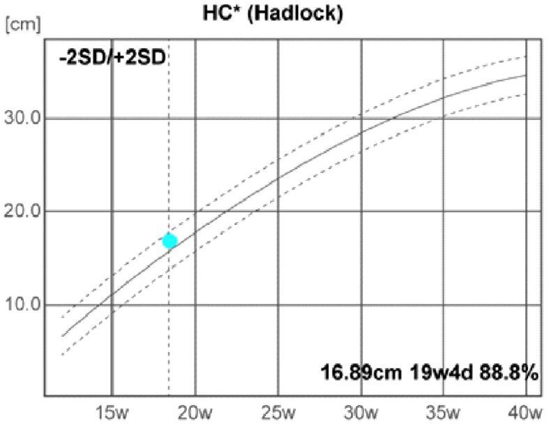 https://cdn.ncbi.nlm.nih.gov/pmc/blobs/dc36/8343603/7ff74361f6cd/RJME-61-4-1309-fig5.jpg