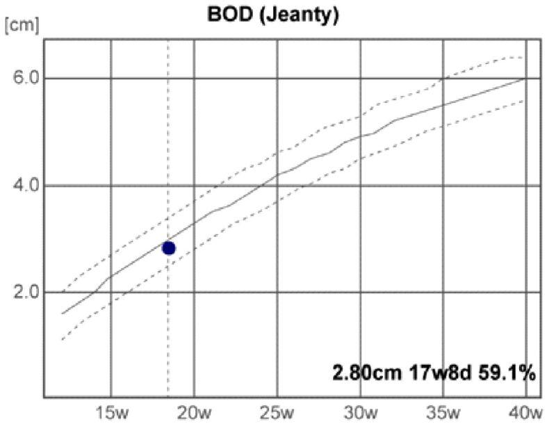 https://cdn.ncbi.nlm.nih.gov/pmc/blobs/dc36/8343603/962fe14b7d3b/RJME-61-4-1309-fig6.jpg