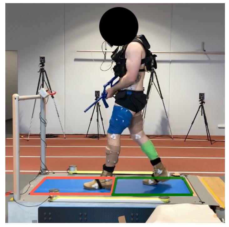 https://cdn.ncbi.nlm.nih.gov/pmc/blobs/dc37/11174954/f57ae7595258/sensors-24-03378-g001.jpg