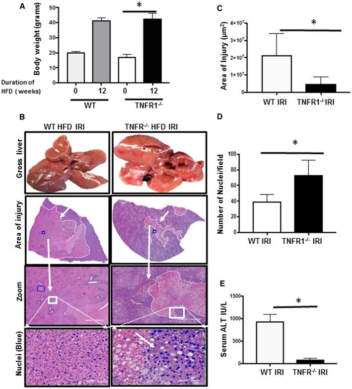 https://cdn.ncbi.nlm.nih.gov/pmc/blobs/dc3b/6601319/e15f500d8862/HEP4-3-925-g001.jpg