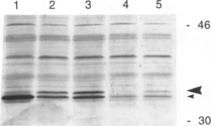 https://cdn.ncbi.nlm.nih.gov/pmc/blobs/dc3d/333732/40ee3ad13ea8/nar00240-0223-b.jpg
