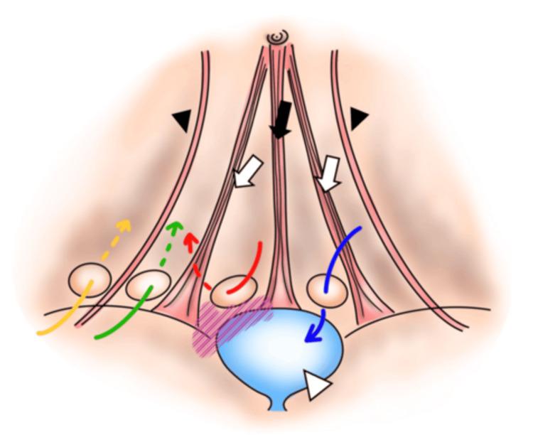 https://cdn.ncbi.nlm.nih.gov/pmc/blobs/dc3e/12395320/9dd7651613dd/cureus-0017-00000089037-i03.jpg