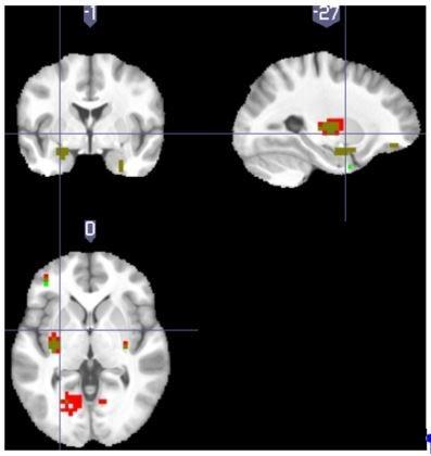 https://cdn.ncbi.nlm.nih.gov/pmc/blobs/dc42/5843408/150a9d46be19/elife-31949-resp-fig1.jpg