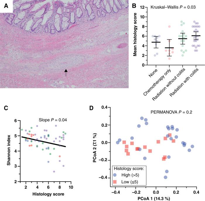 https://cdn.ncbi.nlm.nih.gov/pmc/blobs/dc46/12051095/4b4f8bda29d3/crc-25-0036_f3.jpg