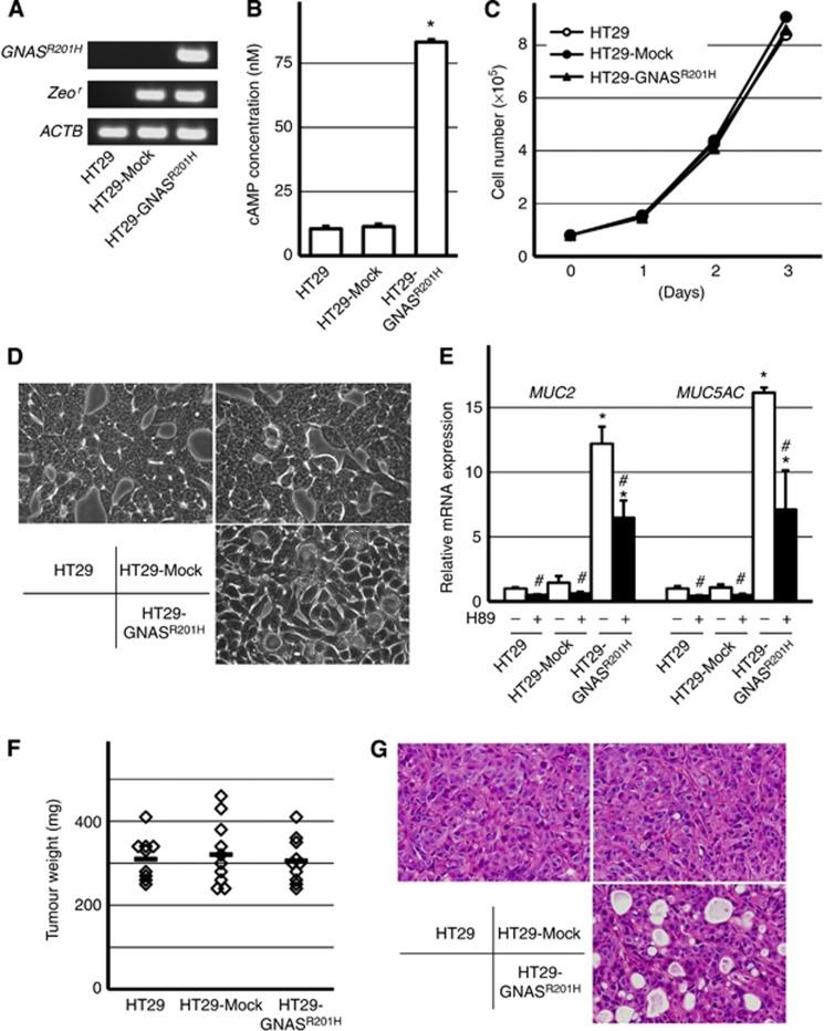 https://cdn.ncbi.nlm.nih.gov/pmc/blobs/dc47/3590682/2777c4bac32c/bjc201347f3.jpg