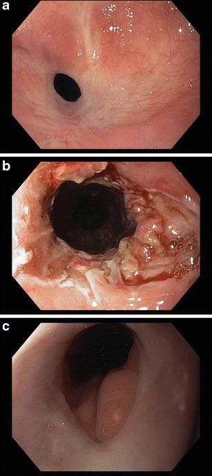 https://cdn.ncbi.nlm.nih.gov/pmc/blobs/dc47/4328110/aac7e2125489/11938_2014_43_Fig1_HTML.jpg