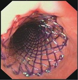 https://cdn.ncbi.nlm.nih.gov/pmc/blobs/dc47/4328110/bab18c66dea6/11938_2014_43_Fig2_HTML.jpg