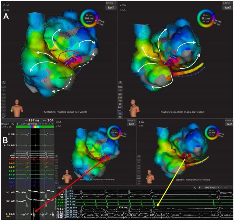 https://cdn.ncbi.nlm.nih.gov/pmc/blobs/dc53/9409392/c6cbee3c38a2/jcdd-09-00249-g007.jpg