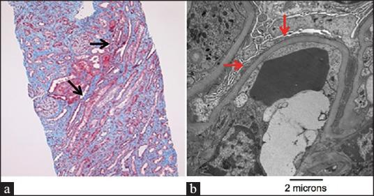 https://cdn.ncbi.nlm.nih.gov/pmc/blobs/dc5c/4525392/078db880149d/NAJMS-7-328-g001.jpg