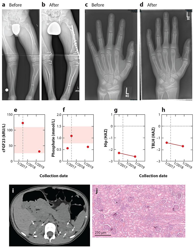 https://cdn.ncbi.nlm.nih.gov/pmc/blobs/dc5d/11062289/62431a75604d/nihms-1984512-f0002.jpg