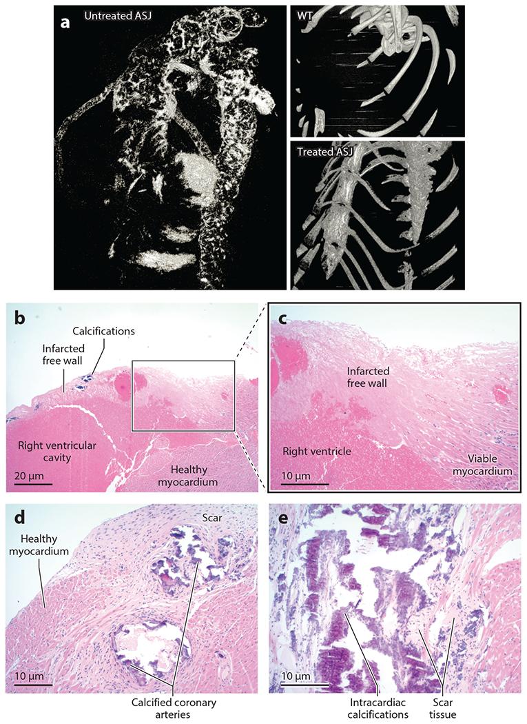 https://cdn.ncbi.nlm.nih.gov/pmc/blobs/dc5d/11062289/6eb84fb6a58f/nihms-1984512-f0009.jpg