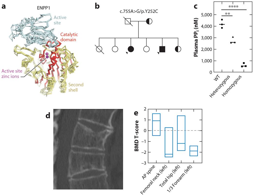 https://cdn.ncbi.nlm.nih.gov/pmc/blobs/dc5d/11062289/e283ab4f8745/nihms-1984512-f0004.jpg