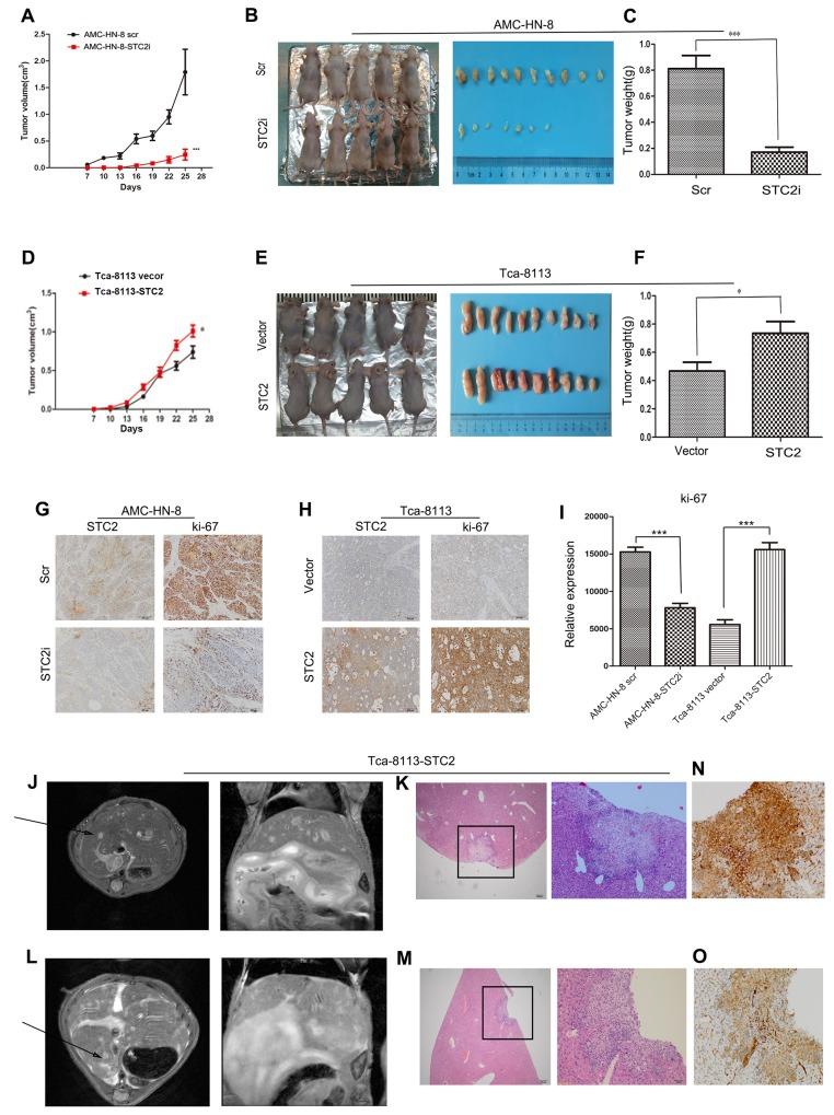 https://cdn.ncbi.nlm.nih.gov/pmc/blobs/dc5d/5351606/4f0d91e67f31/oncotarget-08-5976-g004.jpg