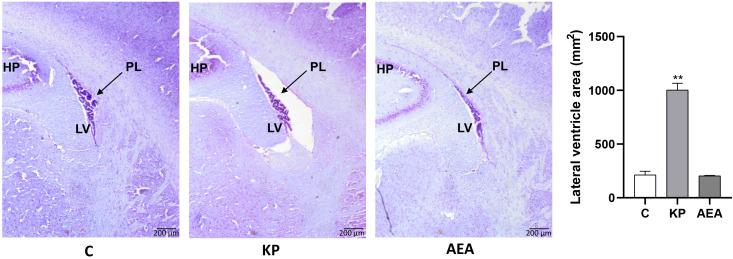 https://cdn.ncbi.nlm.nih.gov/pmc/blobs/dc6f/10602894/2e2ed176ca4a/fendo-14-1269334-g003.jpg