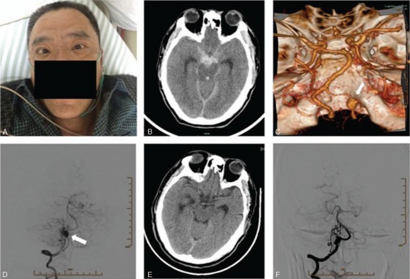 https://cdn.ncbi.nlm.nih.gov/pmc/blobs/dc6f/5779736/1b2729821669/medi-97-e9155-g001.jpg