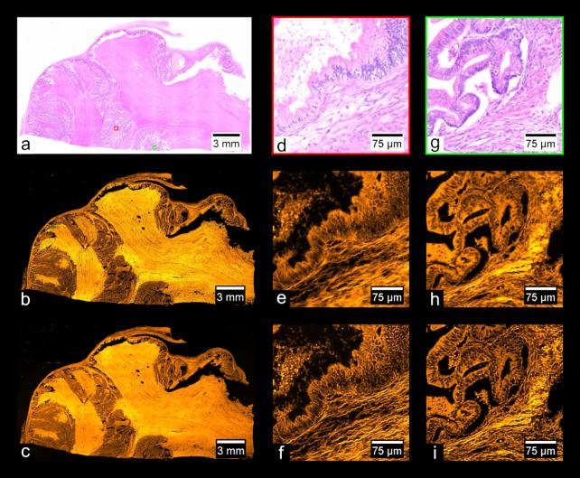 https://cdn.ncbi.nlm.nih.gov/pmc/blobs/dc73/7155289/00656ea4bfb6/giaa035fig11.jpg