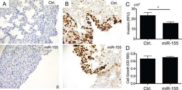 https://cdn.ncbi.nlm.nih.gov/pmc/blobs/dc77/4745722/466f391aa147/oncotarget-06-29224-g003.jpg