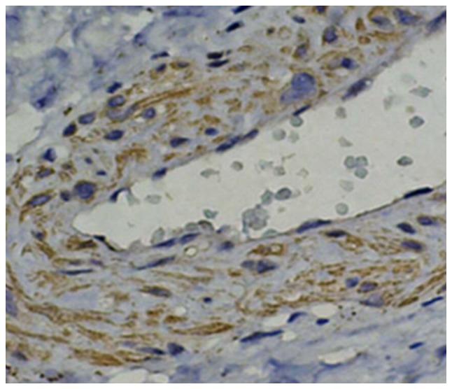 https://cdn.ncbi.nlm.nih.gov/pmc/blobs/dc79/5348675/307e532d495f/etm-13-02-0624-g05.jpg