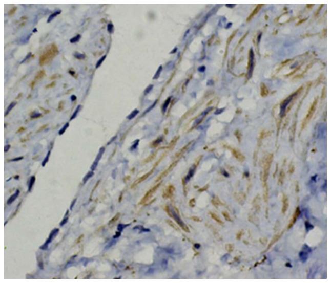 https://cdn.ncbi.nlm.nih.gov/pmc/blobs/dc79/5348675/7cb11af42a34/etm-13-02-0624-g03.jpg
