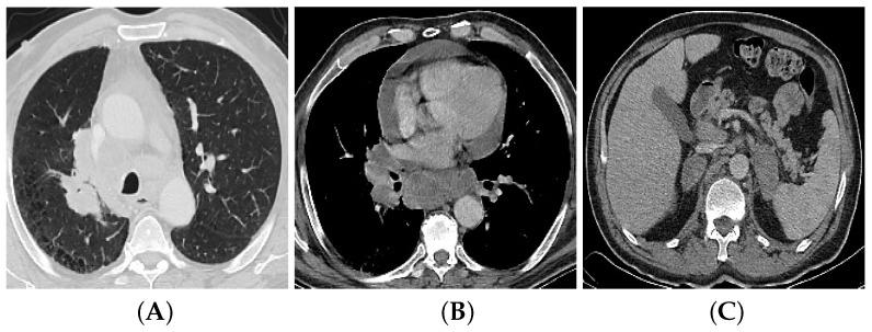 https://cdn.ncbi.nlm.nih.gov/pmc/blobs/dc7c/9598500/6a9e36af3c5a/bioengineering-09-00493-g001.jpg