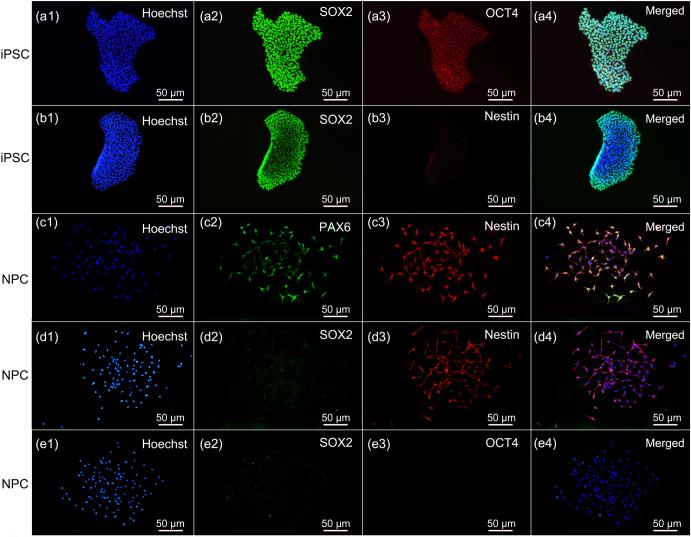 https://cdn.ncbi.nlm.nih.gov/pmc/blobs/dc80/11161384/a6013882d092/boe-15-5-2926-g004.jpg