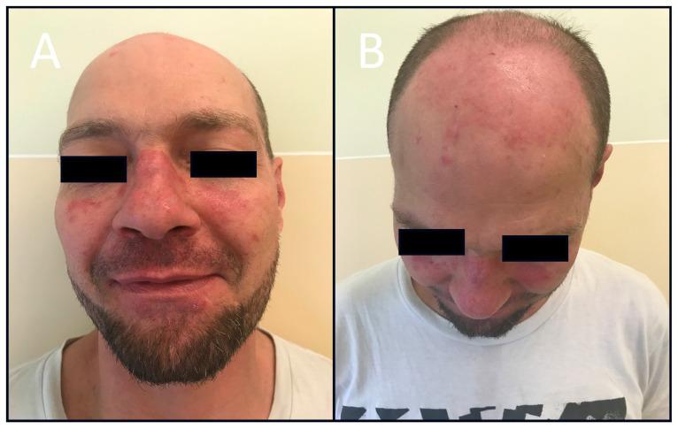 https://cdn.ncbi.nlm.nih.gov/pmc/blobs/dc8d/11312967/4073446f9d8e/jcm-13-04361-g001.jpg