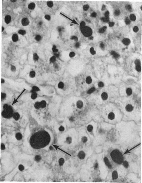 https://cdn.ncbi.nlm.nih.gov/pmc/blobs/dc8d/1970116/0c6d04f3eb8d/brmedj03021-0043-b.jpg