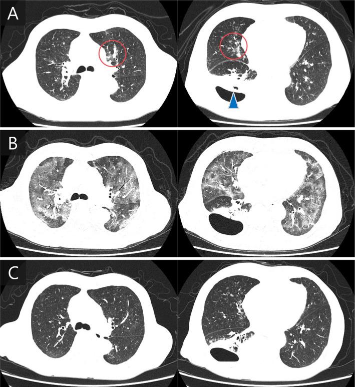 https://cdn.ncbi.nlm.nih.gov/pmc/blobs/dc9b/10713372/b7831952eb58/1349-7235-62-3381-g001.jpg