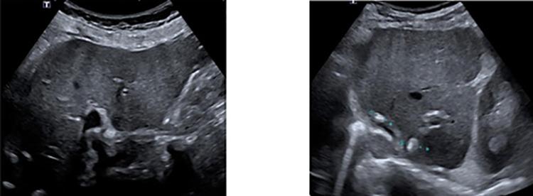 https://cdn.ncbi.nlm.nih.gov/pmc/blobs/dca2/6822535/2a816169a4c5/rjz270f3.jpg