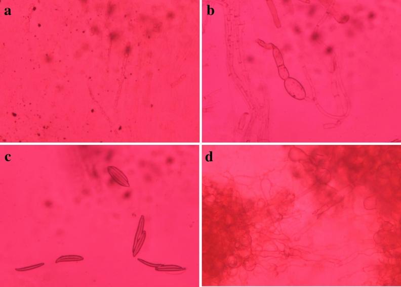 https://cdn.ncbi.nlm.nih.gov/pmc/blobs/dcaa/10928228/c7285968fb8e/41598_2024_56619_Fig4_HTML.jpg