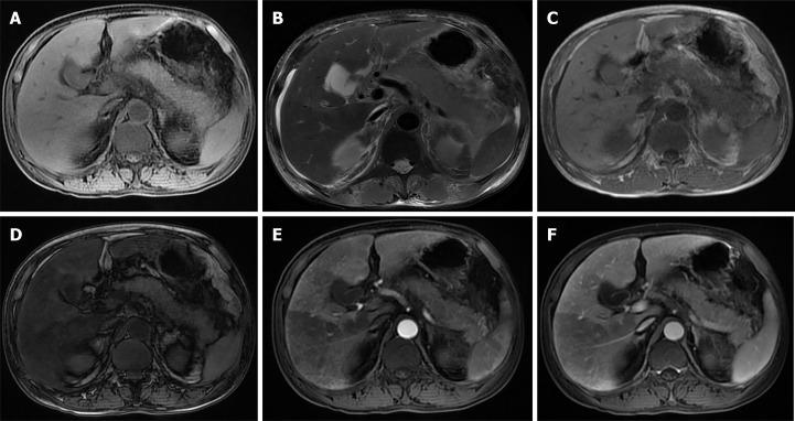 https://cdn.ncbi.nlm.nih.gov/pmc/blobs/dcae/8686151/0e639580472a/WJCC-9-10418-g001.jpg