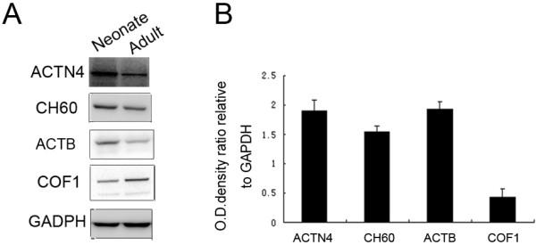 https://cdn.ncbi.nlm.nih.gov/pmc/blobs/dcba/3583686/020fbd145f98/1477-5956-10-65-4.jpg