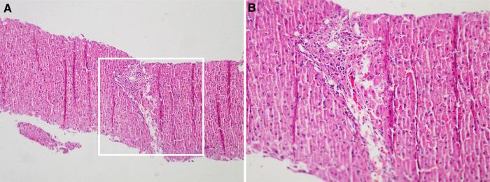 https://cdn.ncbi.nlm.nih.gov/pmc/blobs/dcbc/9852885/9f3049ac861a/fped-10-990729-g001.jpg