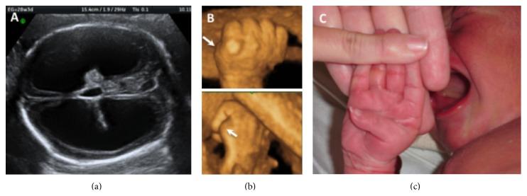 https://cdn.ncbi.nlm.nih.gov/pmc/blobs/dcc5/4452865/cebafb1b4109/CRIOG2015-561713.002.jpg