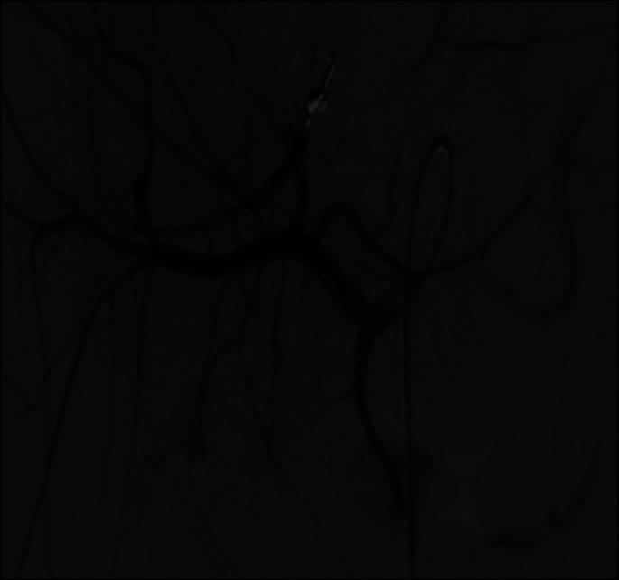https://cdn.ncbi.nlm.nih.gov/pmc/blobs/dccb/9246077/32925bfaf819/ac9-9-e00815-g003.jpg