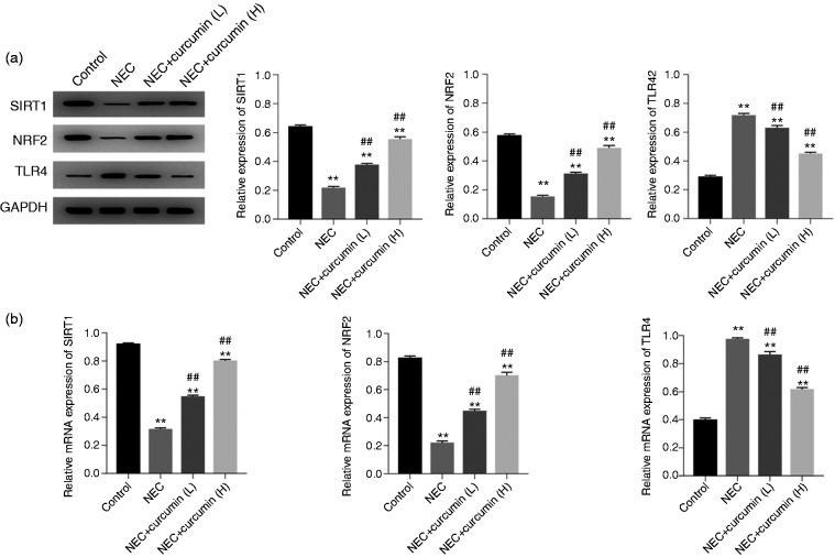 https://cdn.ncbi.nlm.nih.gov/pmc/blobs/dccd/7556186/5432bea10776/10.1177_1753425920933656-fig2.jpg