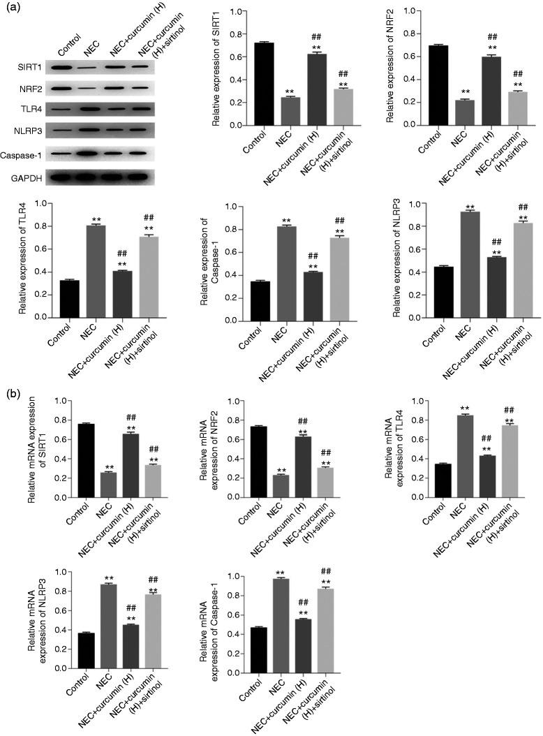 https://cdn.ncbi.nlm.nih.gov/pmc/blobs/dccd/7556186/76258de21ffa/10.1177_1753425920933656-fig3.jpg